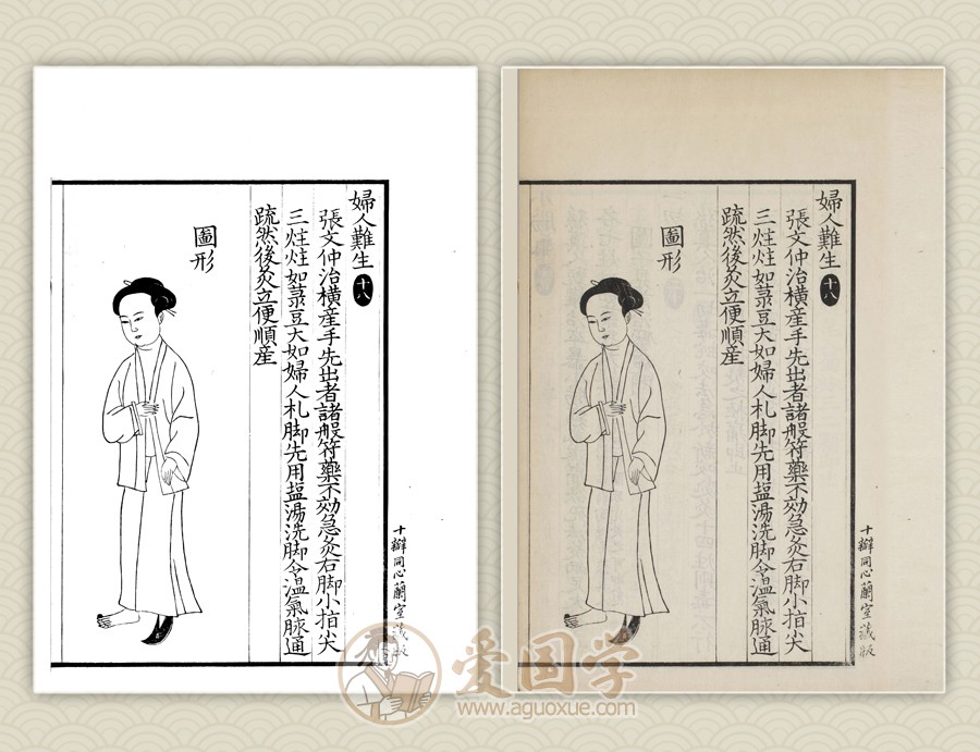 《备急灸方》影宋本 印前拼版可直出打印（附下载）